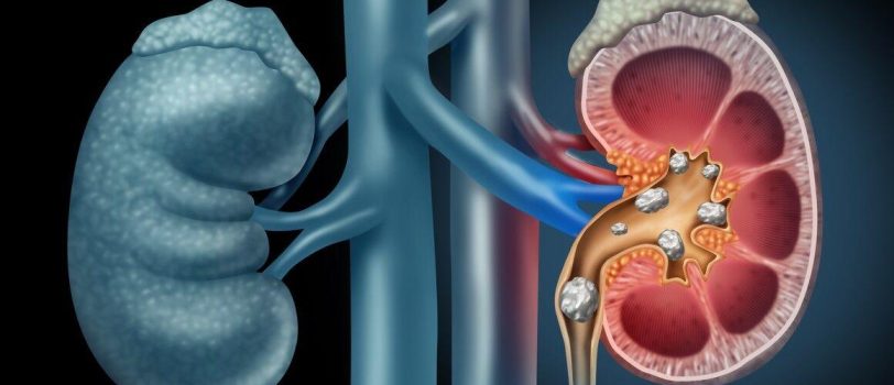 ۱۵۶۷۹۸۷۹۸ 156798798