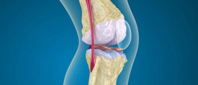 ۴-۷۱-۷۶۸×۴۰۸ 4-71-768x408