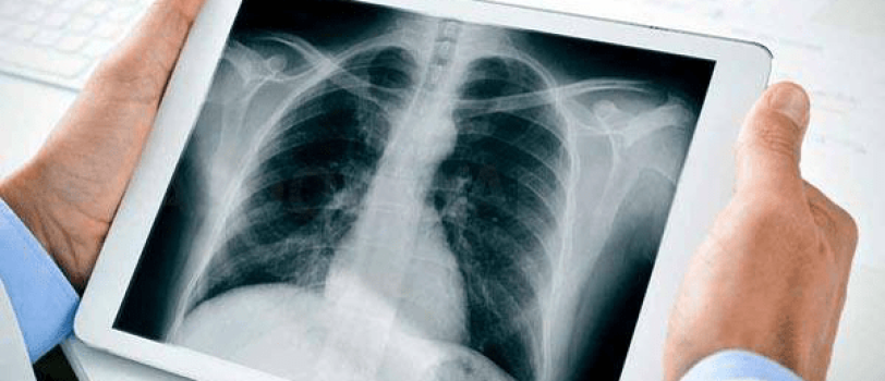 9d0a45cefa6b4e1d845260c56a106b7e 9d0a45cefa6b4e1d845260c56a106b7e