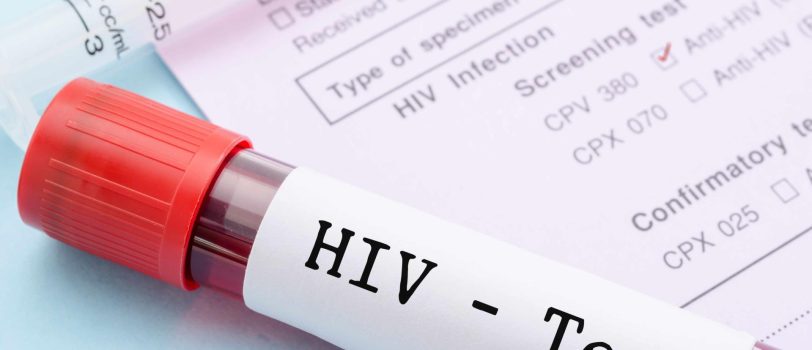 hiv-test hiv-test