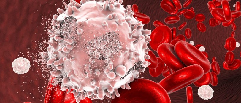 leukemia-1 leukemia-1